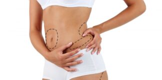 The Benefits and Risks of Liposuction: Is It Right for You